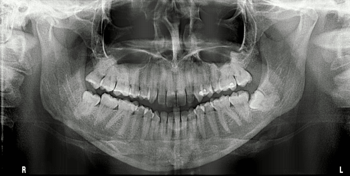 Planowanie leczenia - dentysta Trzebinia, specjalista periodontolog